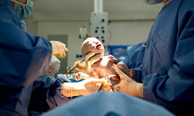 Live birth: C-section surgery 